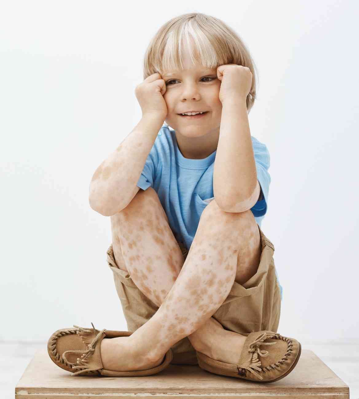 cute little boy with blond hair spots skin sitting with crossed feet holding hands near face smiling with joyful carefree expression looking aside (1)