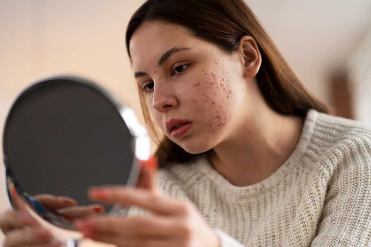 person dealing with rosacea (1)